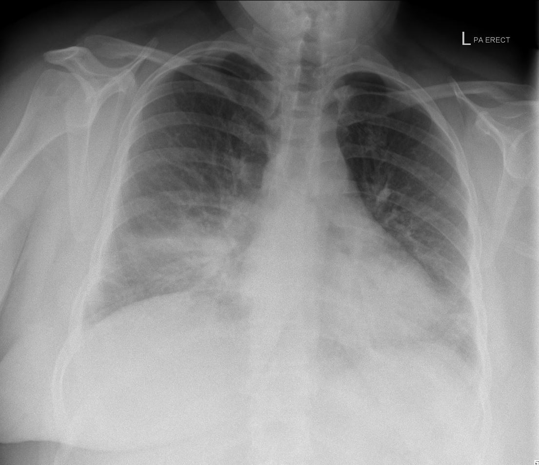 Case 6